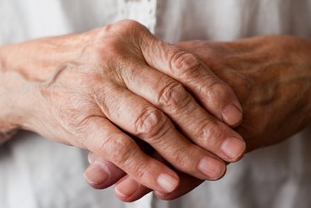 Lifestyle Factors May Influence Risk of Rheumatoid Arthritis
