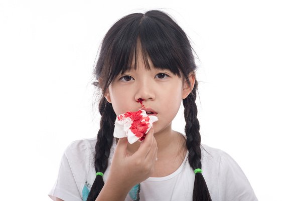 7 Natural Nose Bleed Remedies That Work | If you want to know how to stop nose bleeding at home naturally, we've got tips and tricks to help! We're sharing lots of helpful information, including what causes nose bleeds, how to prevent nose bleeds, and our best home remedies to stop a nose bleed fast. Whether you're looking for tips to stop nose bleeds in kids or adults, we've got you covered!